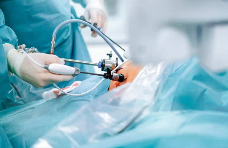 General and Laparoscopic Surgery 